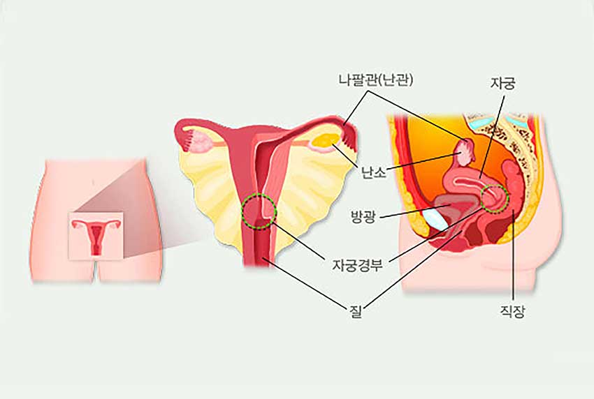 발생부위