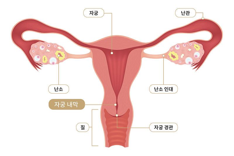 발생부위