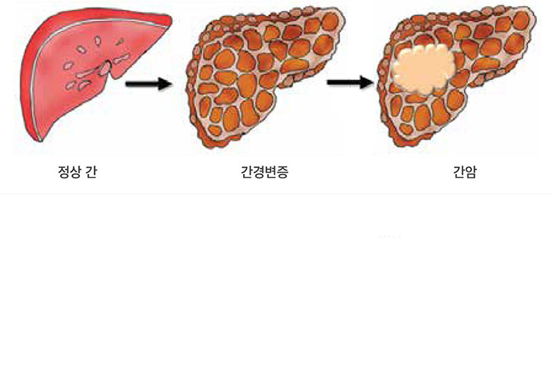 발생부위