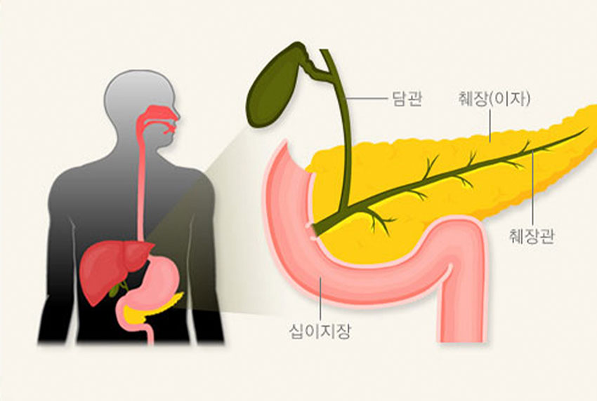 발생부위