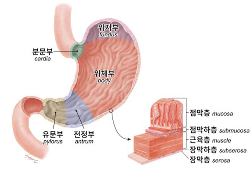 발생부위