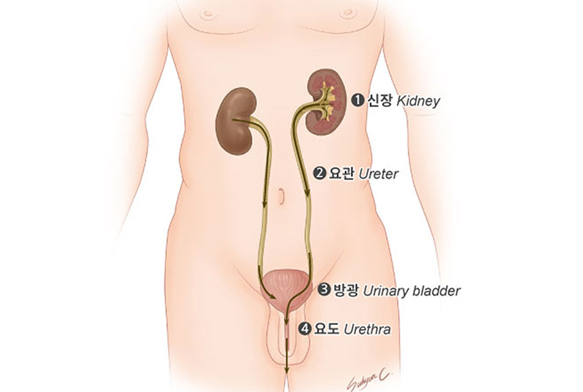 발생부위