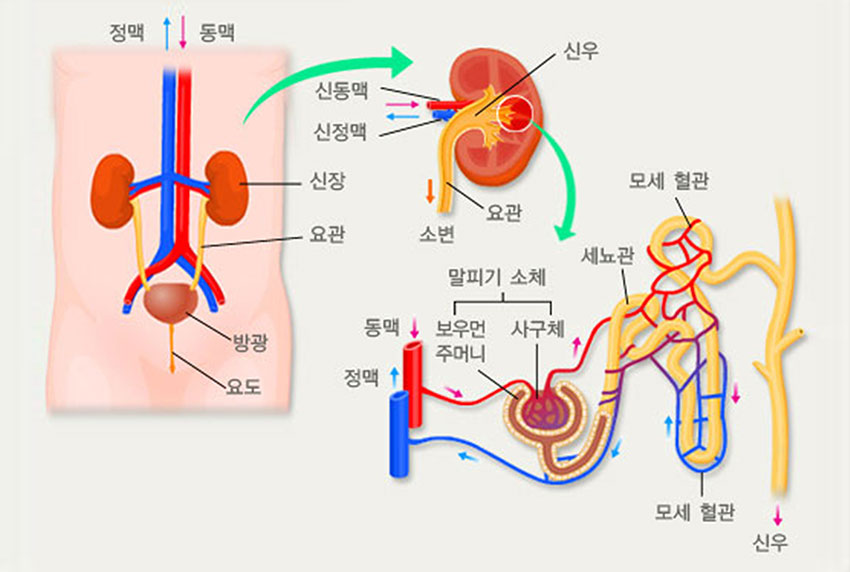 발생부위