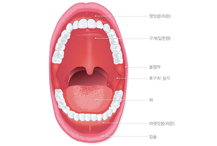 발생부위