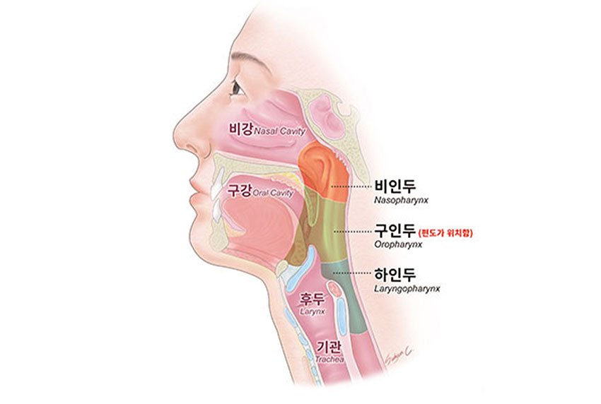 발생부위