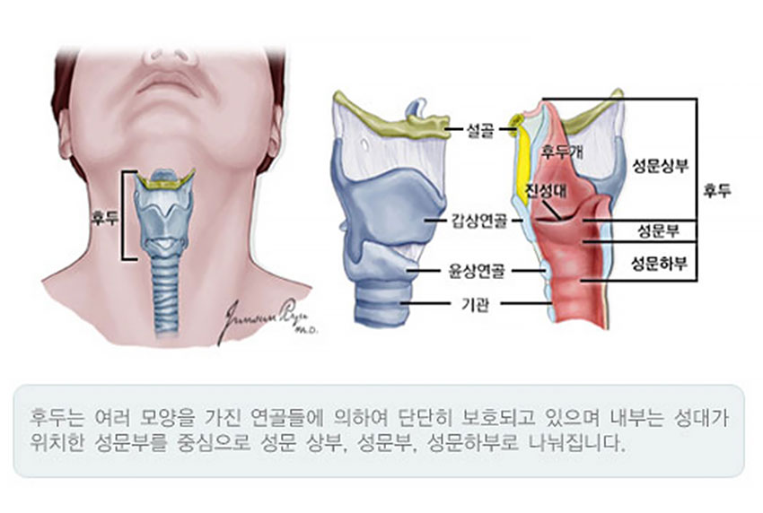 발생부위