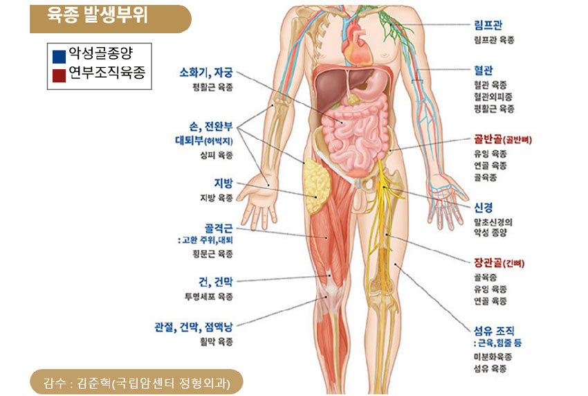 발생부위